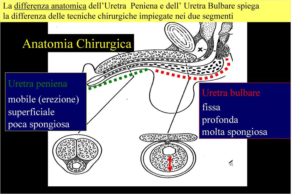 segmenti Anatomia Chirurgica Uretra peniena mobile (erezione)