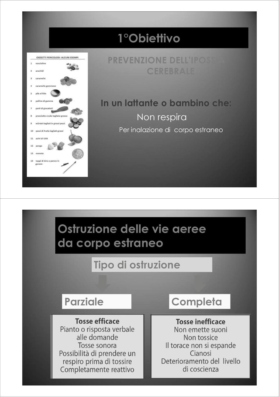 inalazione di corpo estraneo Ostruzione delle vie