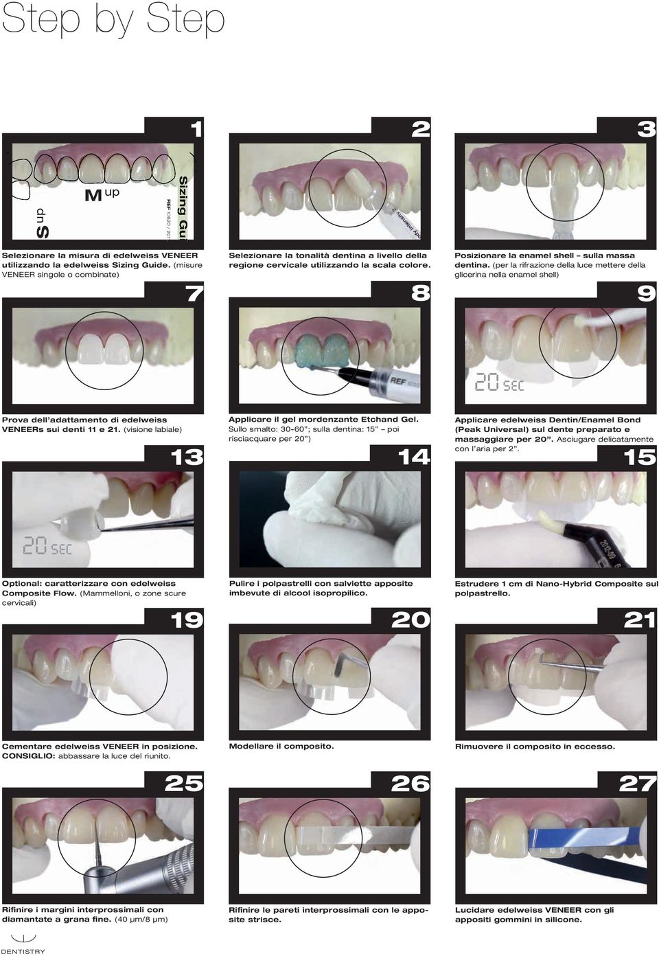 8 Posizionare la enamel shell sulla massa dentina. (per la rifrazione della luce mettere della glicerina nella enamel shell) 9 Prova dell adattamento di edelweiss VENEERs sui denti 11 e 21.