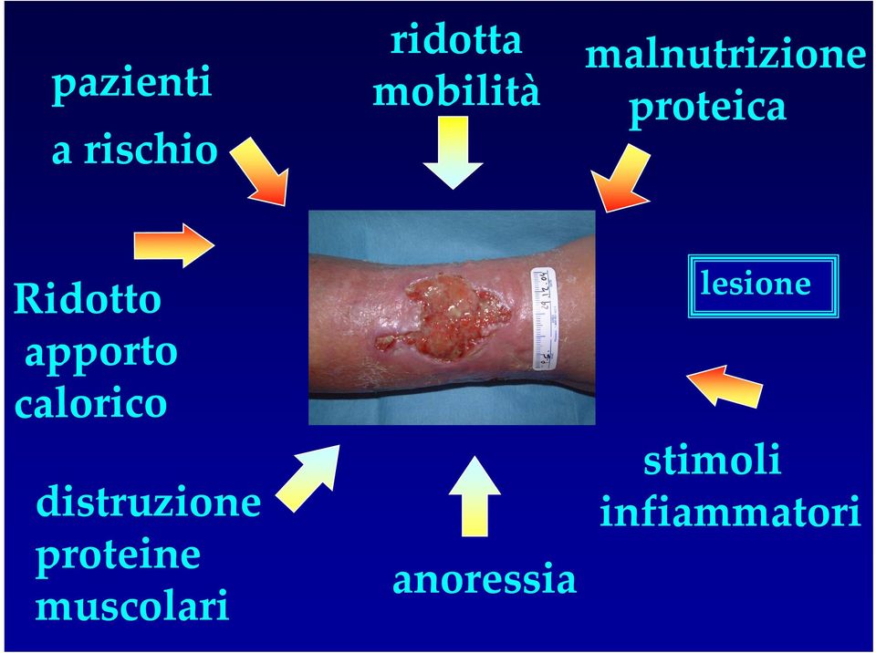 lesione stimoli distruzione i