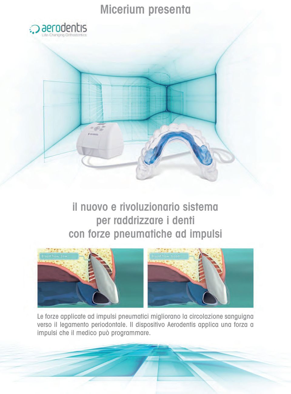 migliorano la circolazione sanguigna verso il legamento periodontale.