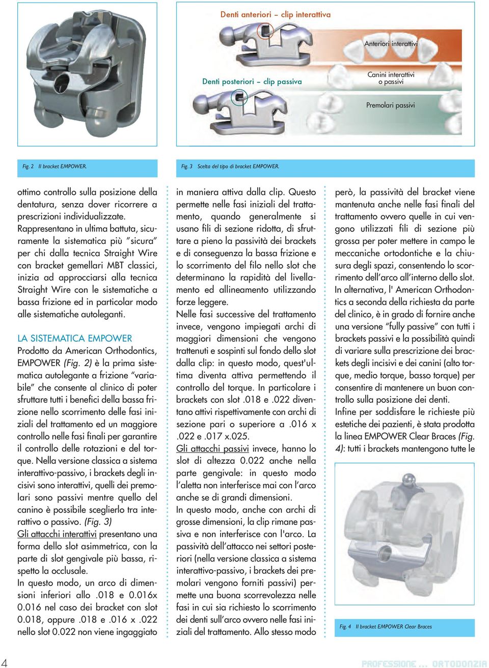 Rappresentano in ultima battuta, sicuramente la sistematica più sicura per chi dalla tecnica Straight Wire con bracket gemellari MBT classici, inizia ad approcciarsi alla tecnica Straight Wire con le