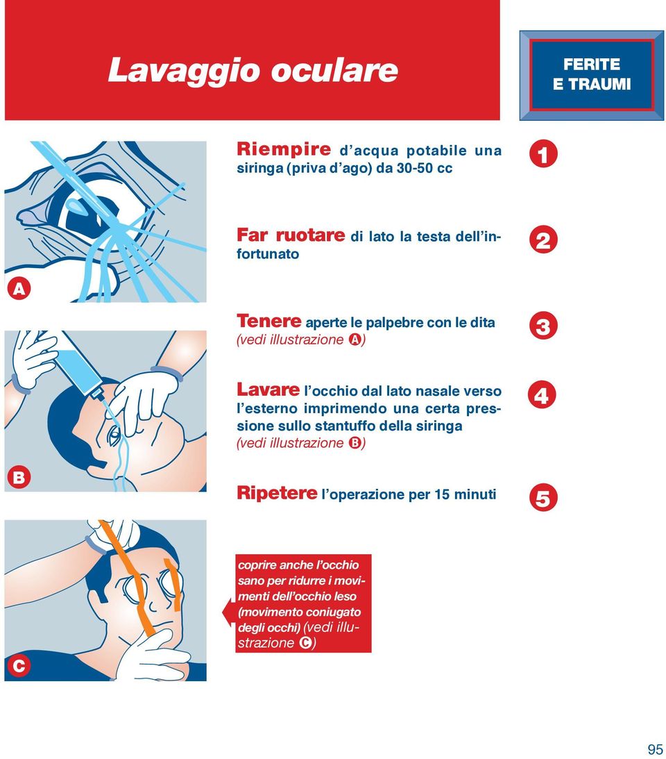 esterno imprimendo una certa pressione sullo stantuffo della siringa (vedi illustrazione ) Ripetere l operazione per 5 minuti