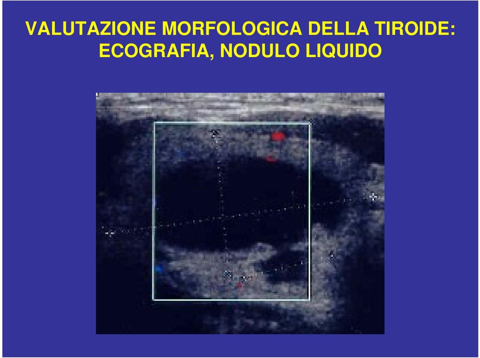 DELLA TIROIDE: