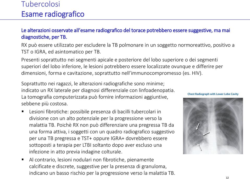 Presenti soprattutto nei segmenti apicale e posteriore del lobo superiore o dei segmenti superiori del lobo inferiore, le lesioni potrebbero essere localizzate ovunque e differire per dimensioni,