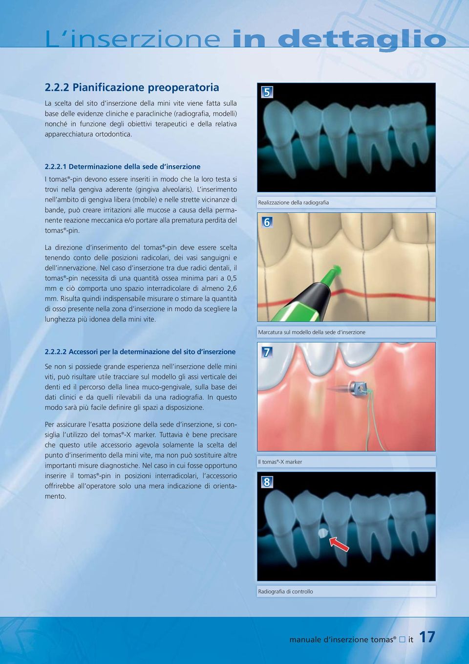 obiettivi terapeutici e della relativa apparecchiatura ortodontica. 5 2.