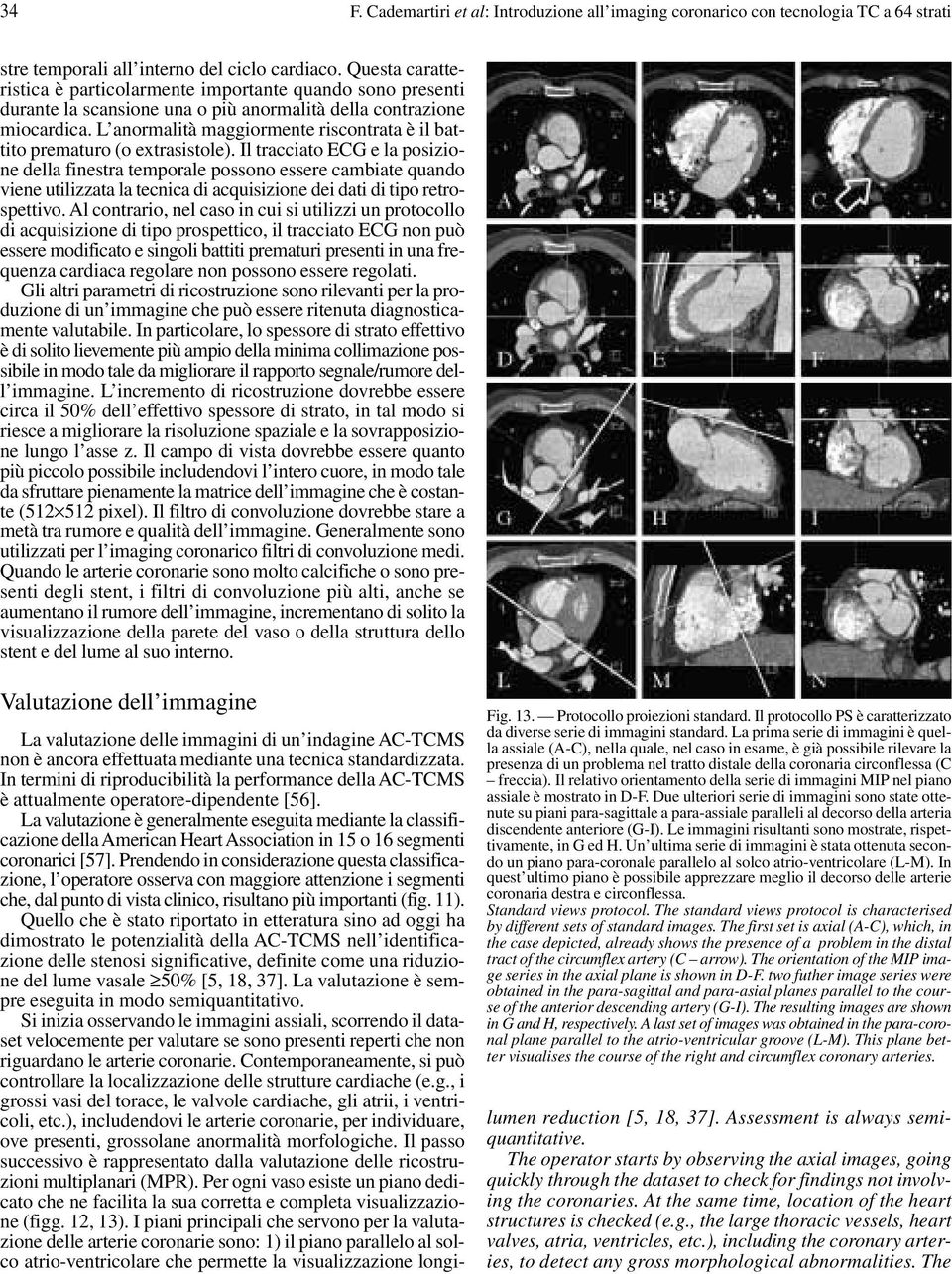 L anormalità maggiormente riscontrata è il battito prematuro (o extrasistole).