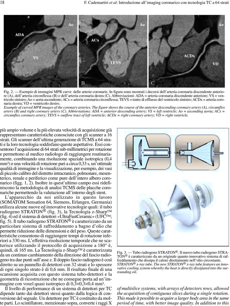 Abbreviazioni: ADA = arteria coronaria discendente anteriore; VS = ventricolo sinistro; Ao = aorta ascendente; ACx = arteria coronaria circonflessa; TEVS = tratto di efflusso del ventricolo sinistro;