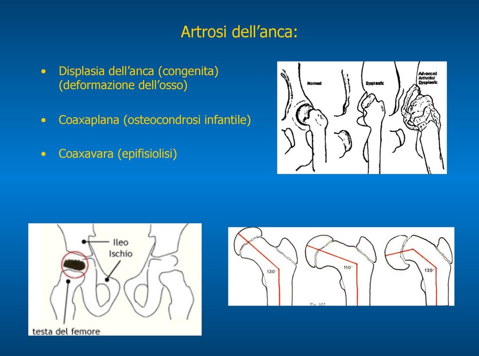 dell osso) Coaxaplana