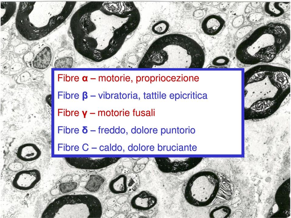 tattile epicritica motorie fusali