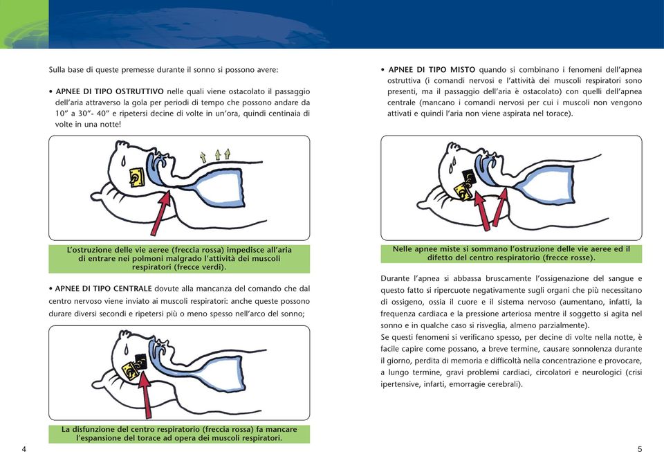 APNEE DI TIPO MISTO quando si combinano i fenomeni dell apnea ostruttiva (i comandi nervosi e l attività dei muscoli respiratori sono presenti, ma il passaggio dell aria è ostacolato) con quelli dell