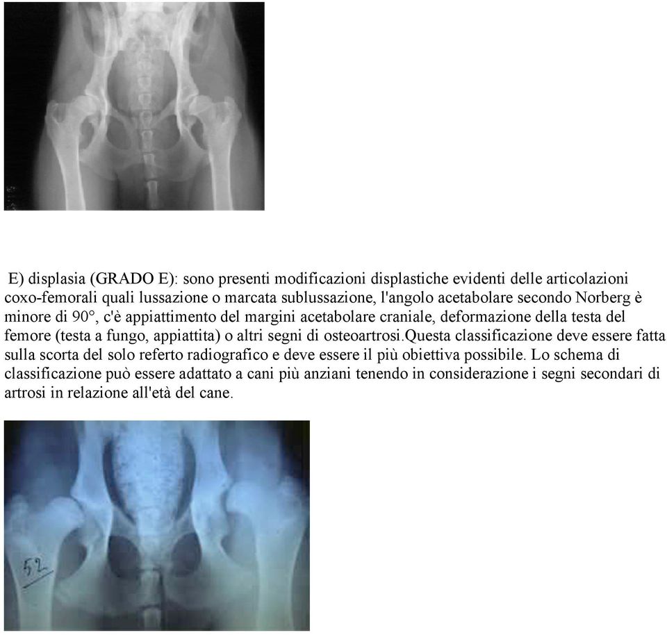 appiattita) o altri segni di osteoartrosi.