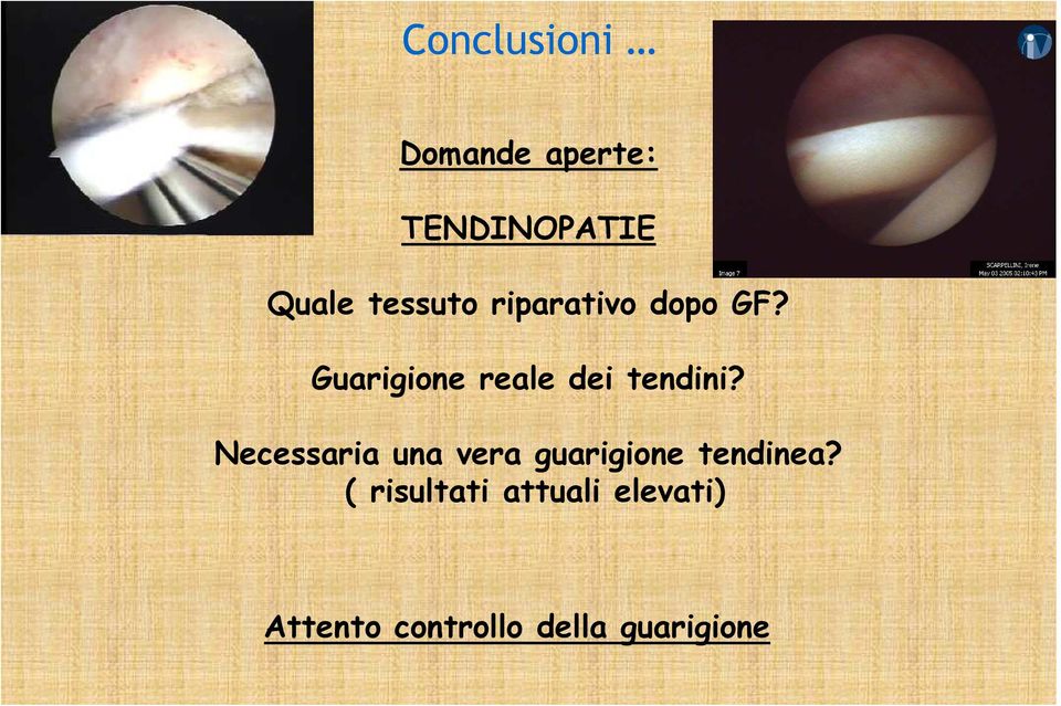 Guarigione reale dei tendini?