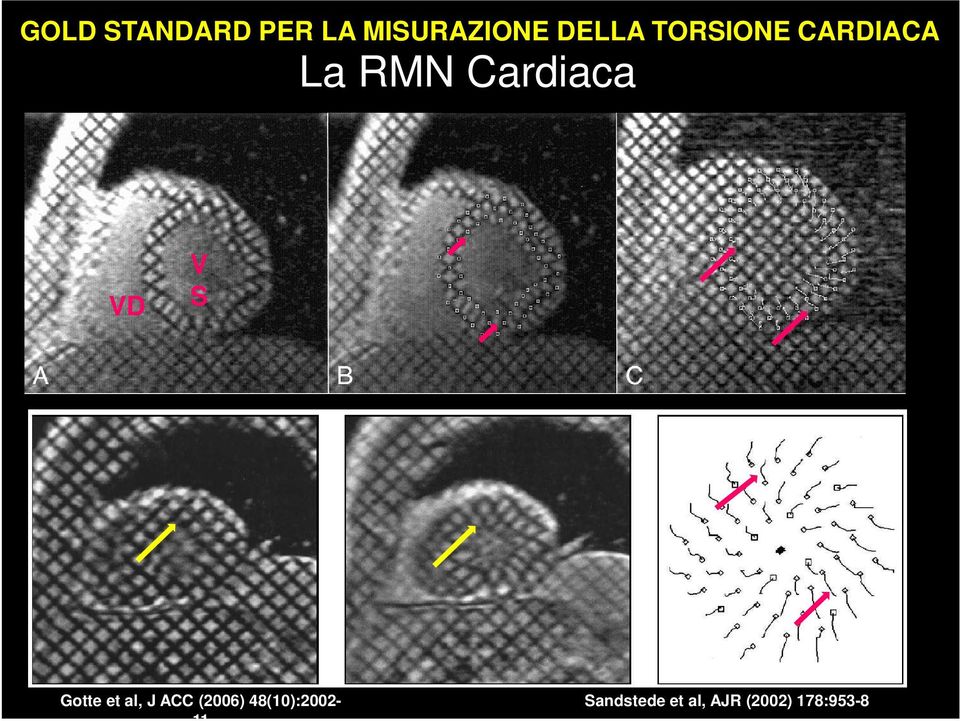 S Gotte et al, J ACC (2006)