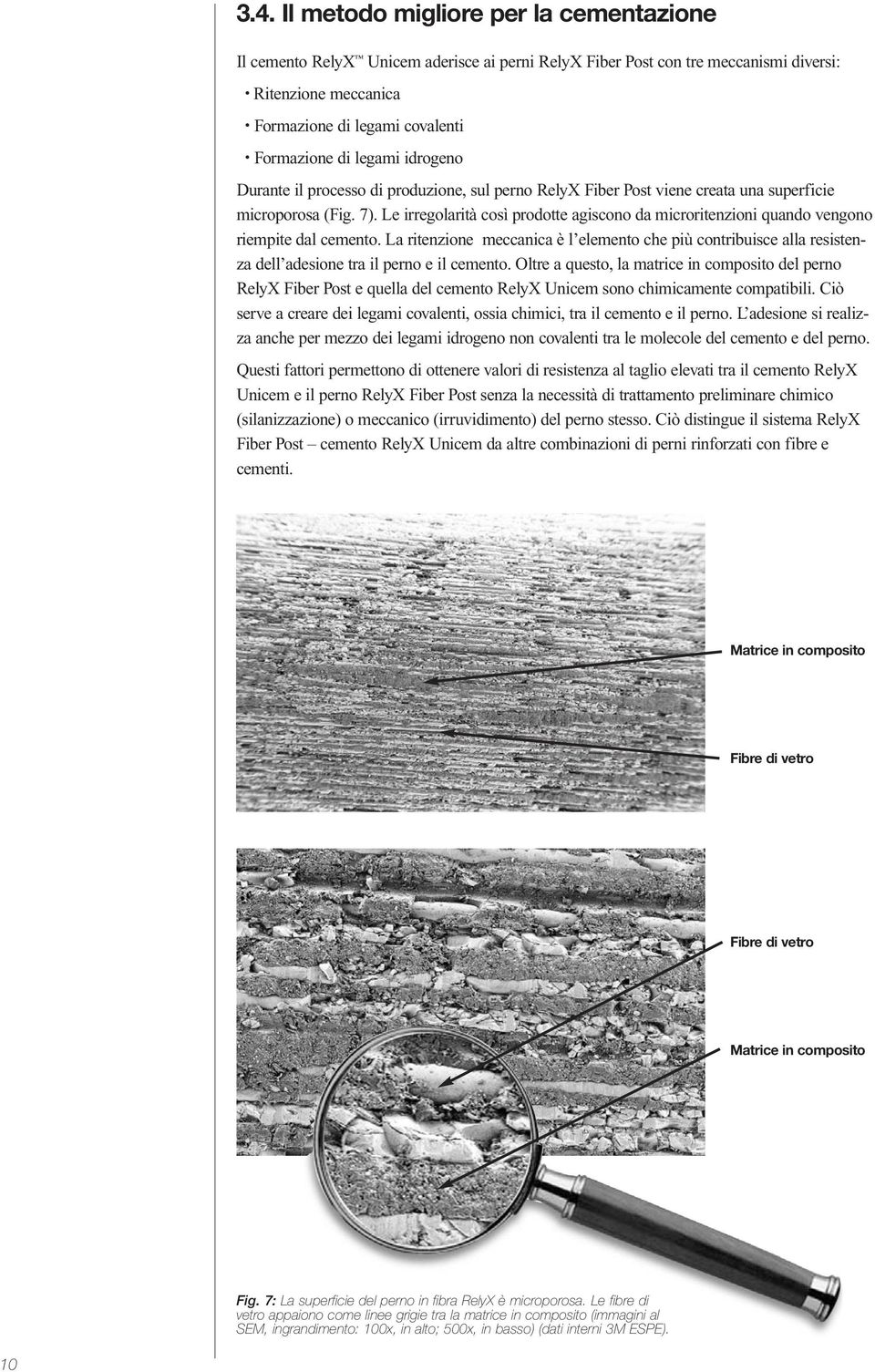 Le irregolarità così prodotte agiscono da microritenzioni quando vengono riempite dal cemento.