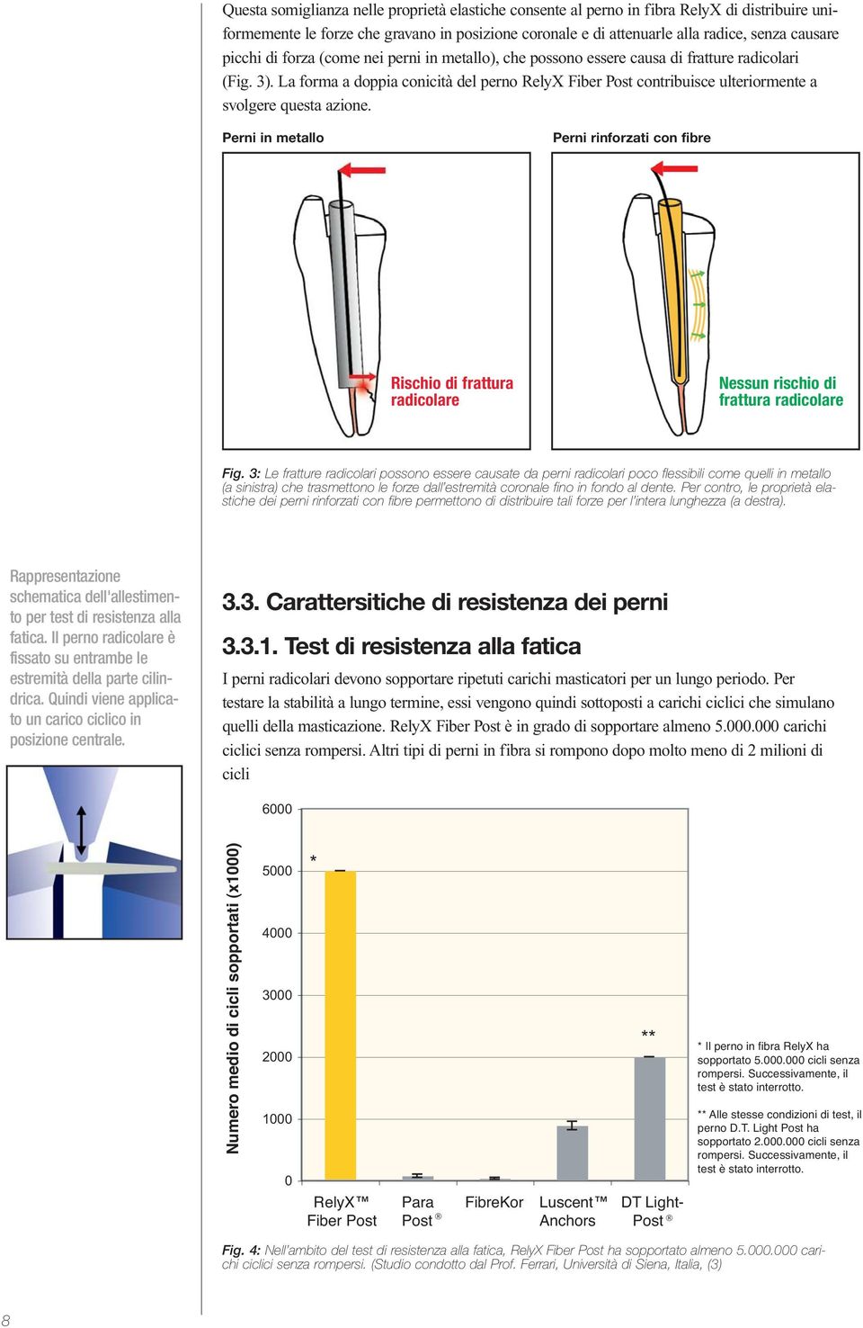 La forma a doppia conicità del perno RelyX Fiber Post contribuisce ulteriormente a svolgere questa azione.