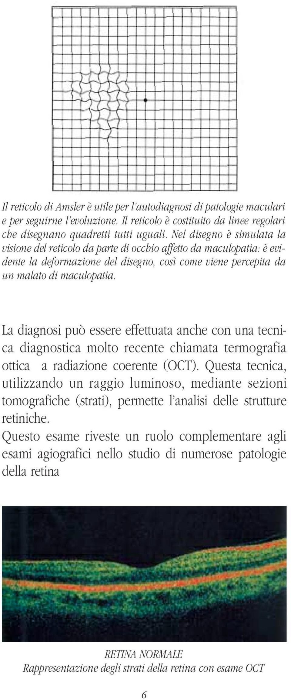 La diagnosi può essere effettuata anche con una tecnica diagnostica molto recente chiamata termografia ottica a radiazione coerente (OCT).