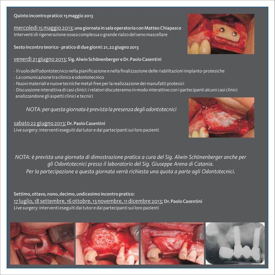 Paolo Casentini - Il ruolo dell'odontotecnico nella pianificazione e nella finalizzazione delle riabilitazioni implanto-protesiche - La comunicazione tra clinico e odontotecnico - Nuovi materiali e