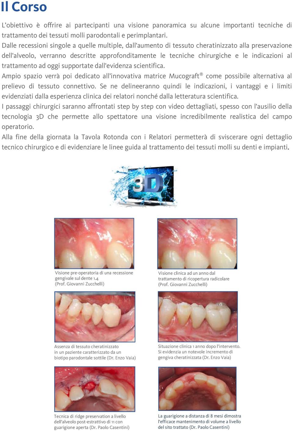 trattamento ad oggi supportate dall'evidenza scientifica. Ampio spazio verrà poi dedicato all innovativa matrice Mucograft come possibile alternativa al prelievo di tessuto connettivo.