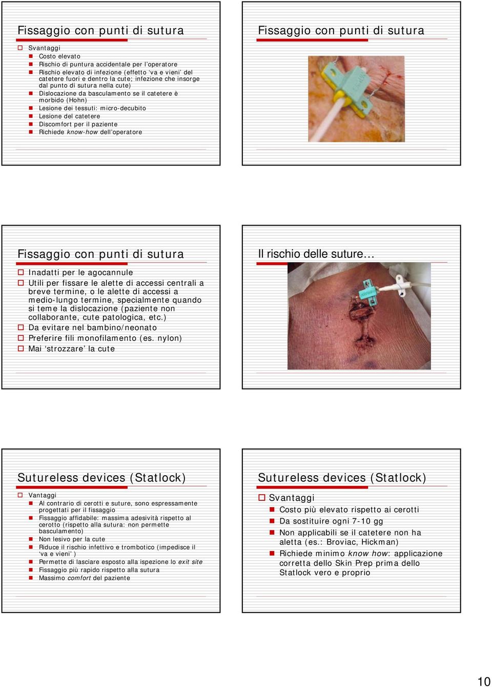 Discomfort per il paziente Richiede know-how dell operatore Fissaggio con punti di sutura Il rischio delle suture Inadatti per le agocannule Utili per fissare le alette di accessi centrali a breve