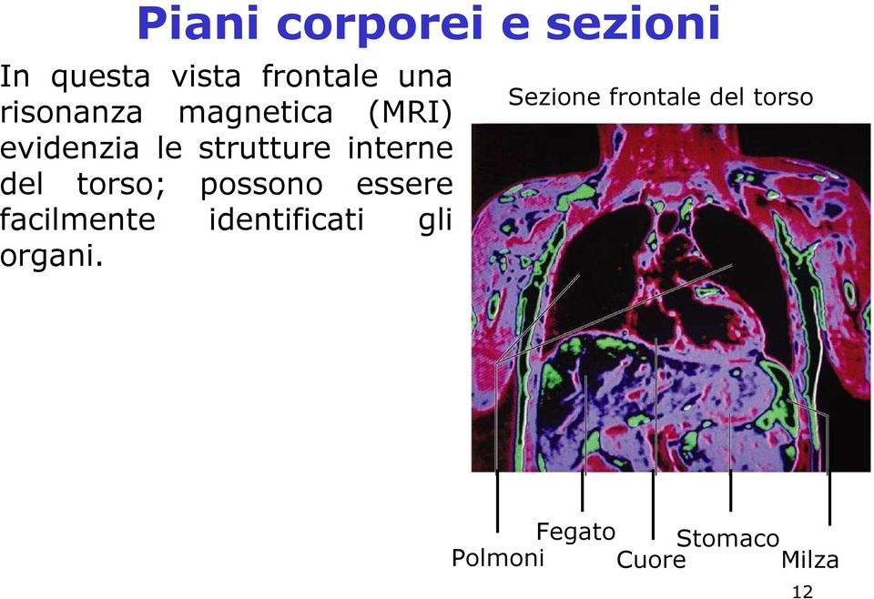 del torso; possono essere facilmente identificati gli