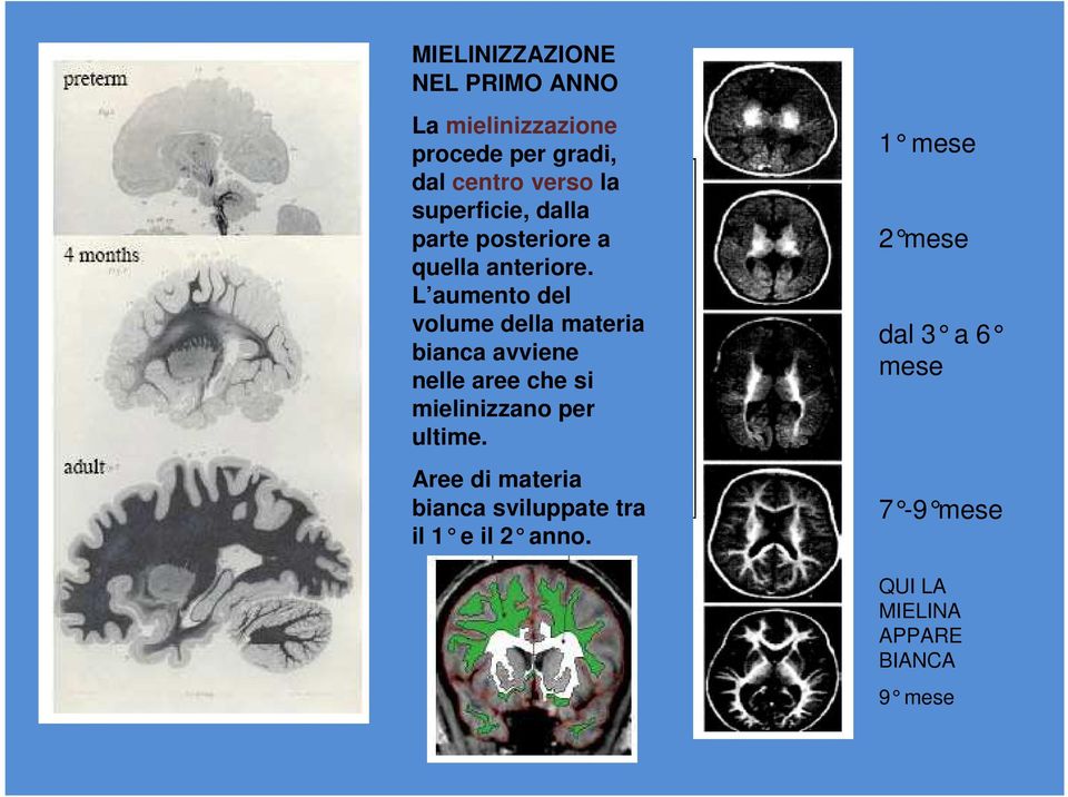 L aumento del volume della materia bianca avviene nelle aree che si mielinizzano per ultime.