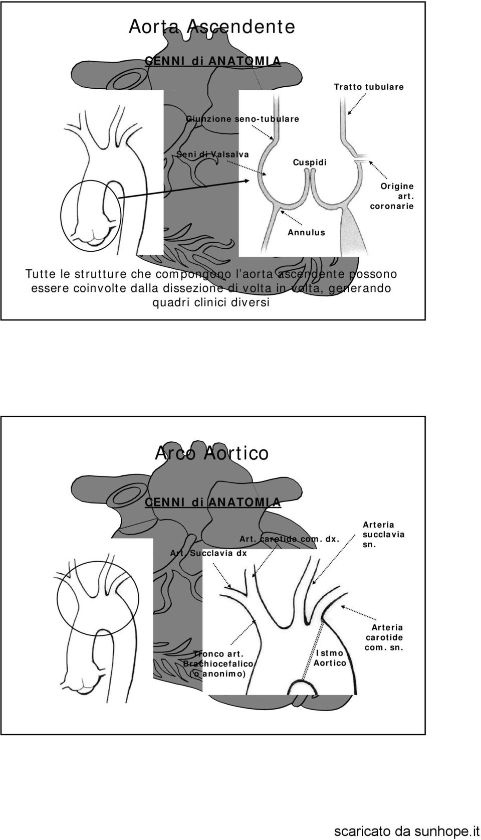 di volta in volta, generando quadri clinici diversi Arco Aortico CENNI di ANATOMIA Art. Succlavia dx Art.