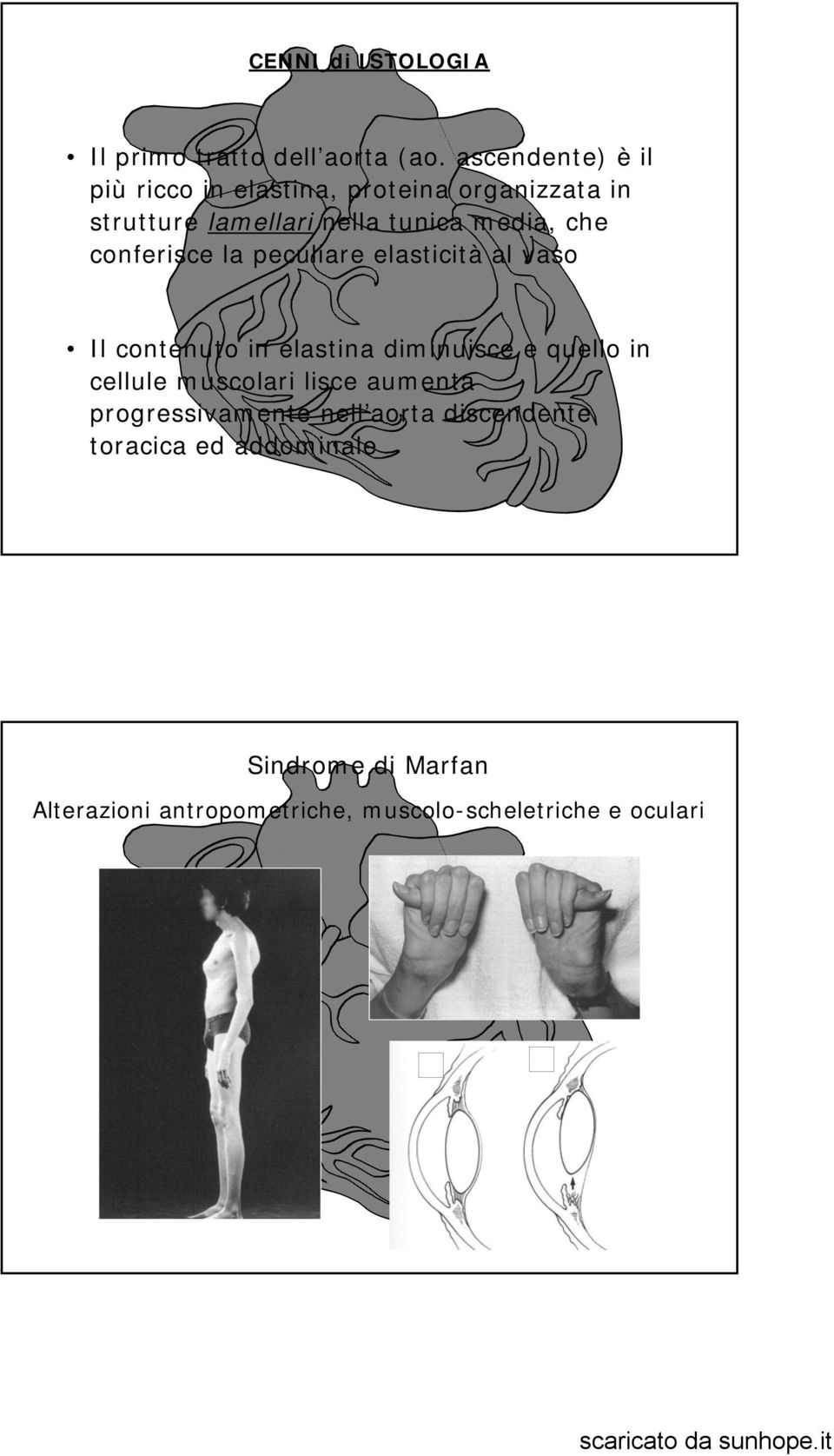 che conferisce la peculiare elasticità al vaso Il contenuto in elastina diminuisce e quello in cellule