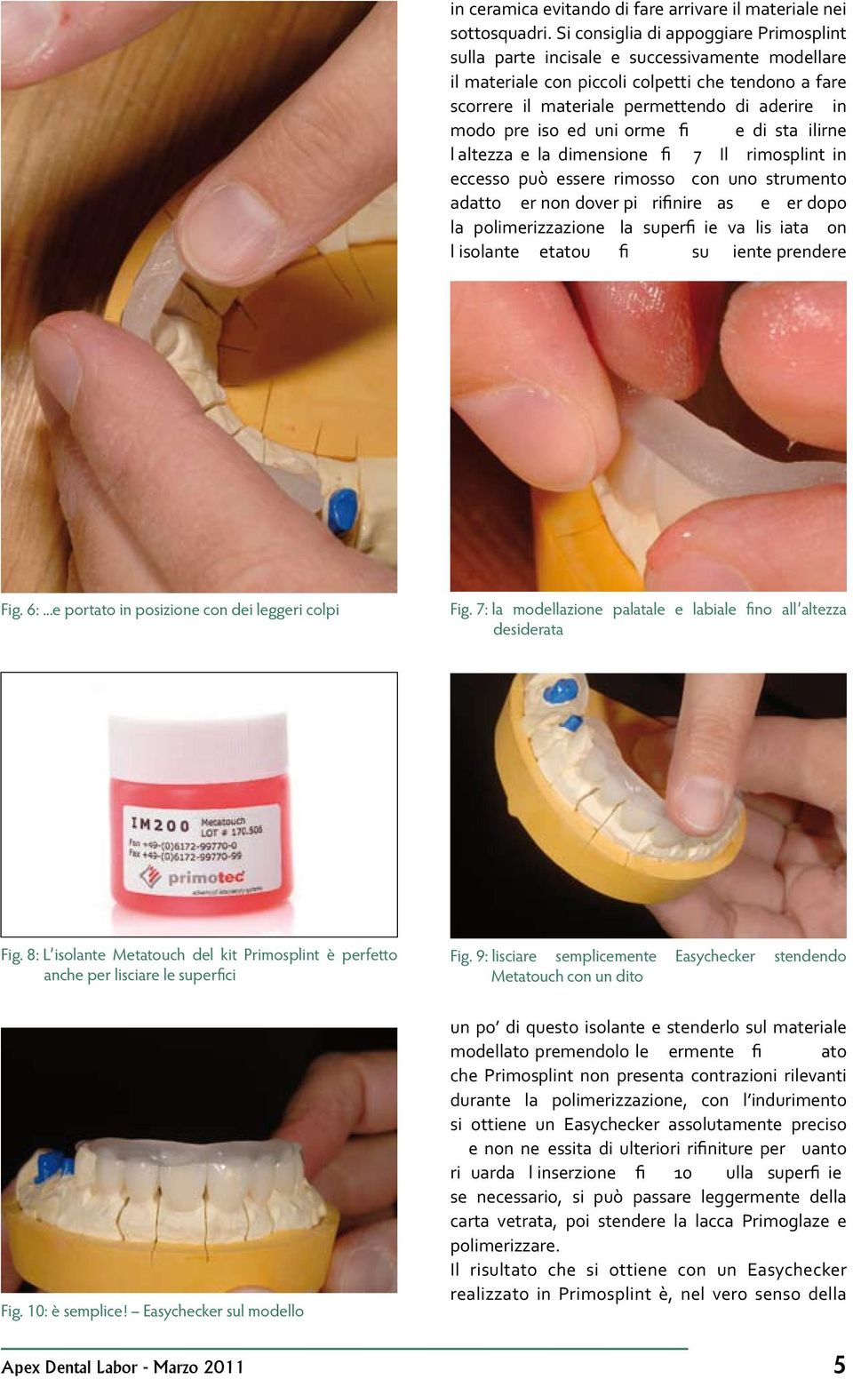 preciso ed uniforme (fig. 6) e di stabilirne l altezza e la dimensione (fig. 7). Il Primosplint in eccesso può essere rimosso con uno strumento adatto.