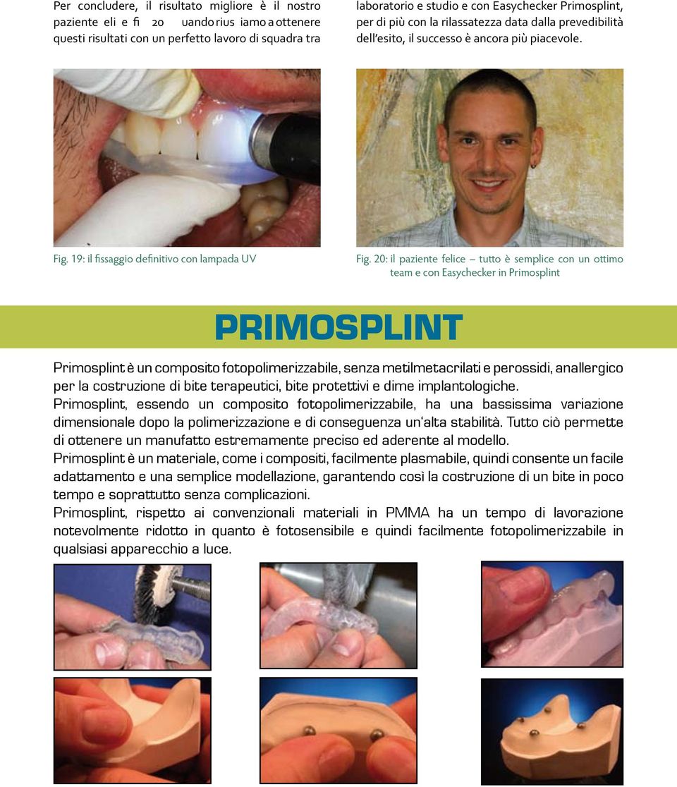 esito, il successo è ancora più piacevole. Fig. 19: il fissaggio definitivo con lampada UV Fig.