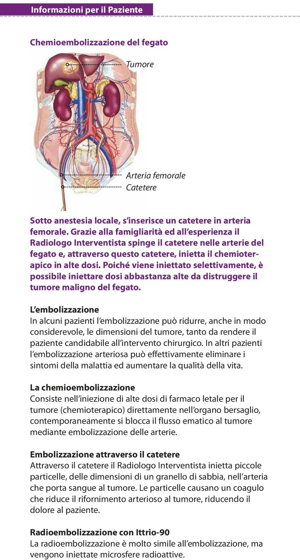 Poiché viene iniettato selettivamente, è possibile iniettare dosi abbastanza alte da distruggere il tumore maligno del fegato.