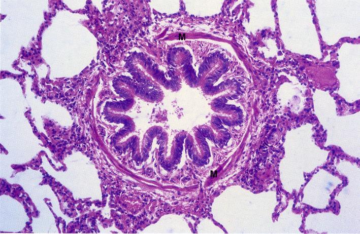 PARETE DEI BRONCHI INTRAPOLMONARI 1) tonaca mucosa è pieghettata longitudinalmente