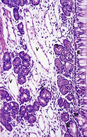 tonaca mucosa delle fosse nasali e dei seni paranasali 1) mucosa respiratoria epitelio pseudostratificato poggia su una lamina propria tessuto connettivo lasso contenente ghiandole tubuloacinose