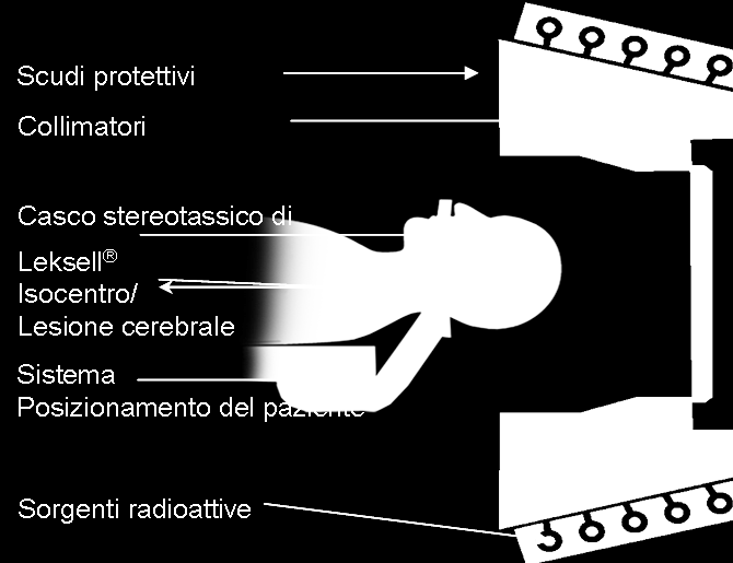 Gamma Knife Gamma Knife ( bisturi a raggi gamma ) é un apparecchiatura dedicata alla Radiochirurgia Stereotassica.