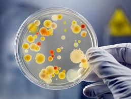 Le Colture Microbiche si ottengono seminando sulla superficie dell agar il materiale microbico che si deve analizzare, si parla di PIASTRATURA, ogni cellula potrà riprodursi sul terreno solido