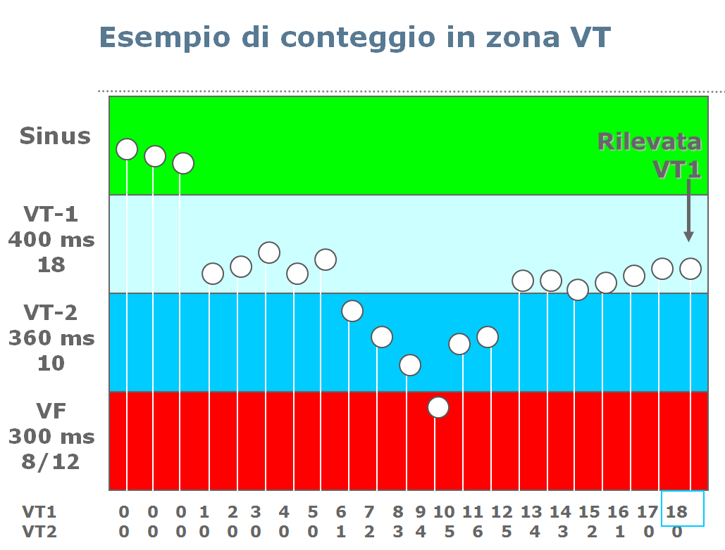 Per la fibrillazione ventricolare, considerata la irregolarità e la caoticità del segnale (con rischio di difetto di sensing) il criterio di riconoscimento è percentuale