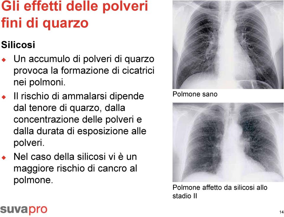 Il rischio di ammalarsi dipende dal tenore di quarzo, dalla concentrazione delle polveri e dalla