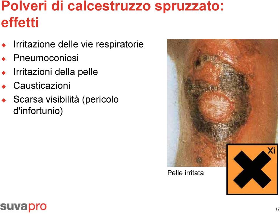 Pneumoconiosi Irritazioni della pellee