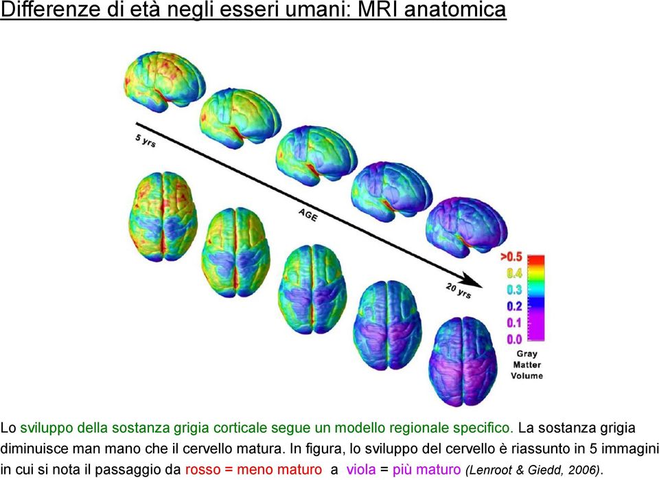 La sostanza grigia diminuisce man mano che il cervello matura.