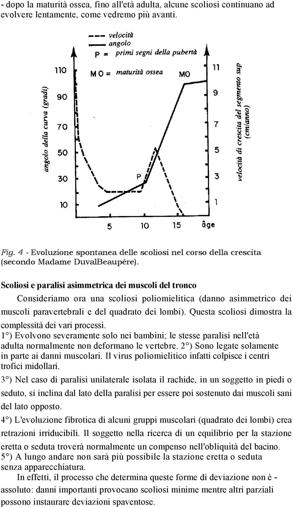 Scoliosi e paralisi asimmetrica dei muscoli del tronco Consideriamo ora una scoliosi poliomielitica (danno asimmetrico dei muscoli paravertebrali e del quadrato dei lombi).