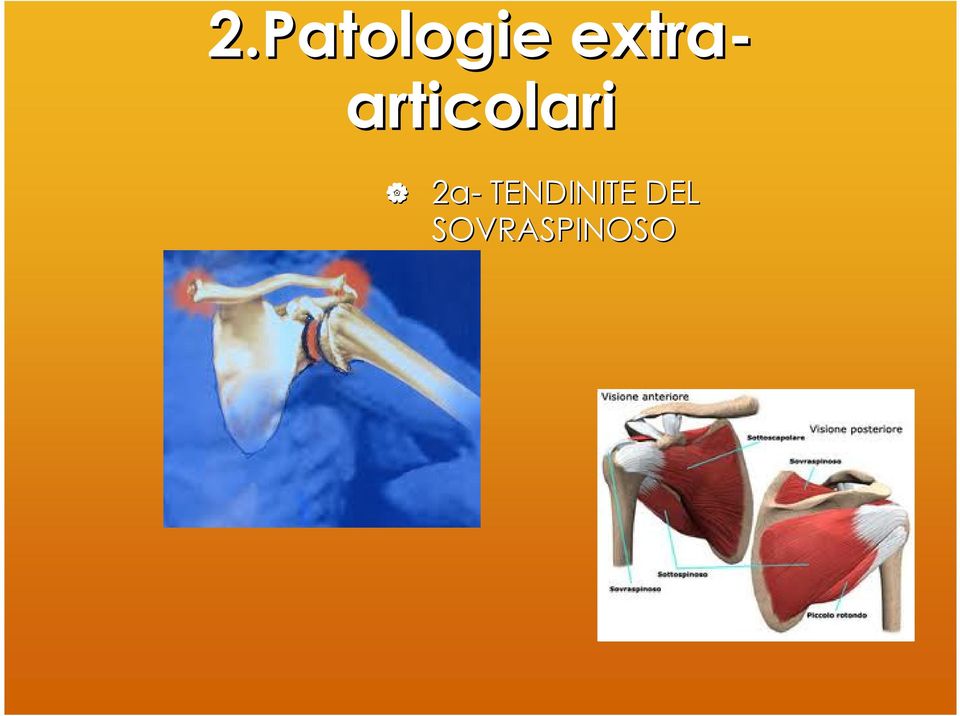 articolari 2a-