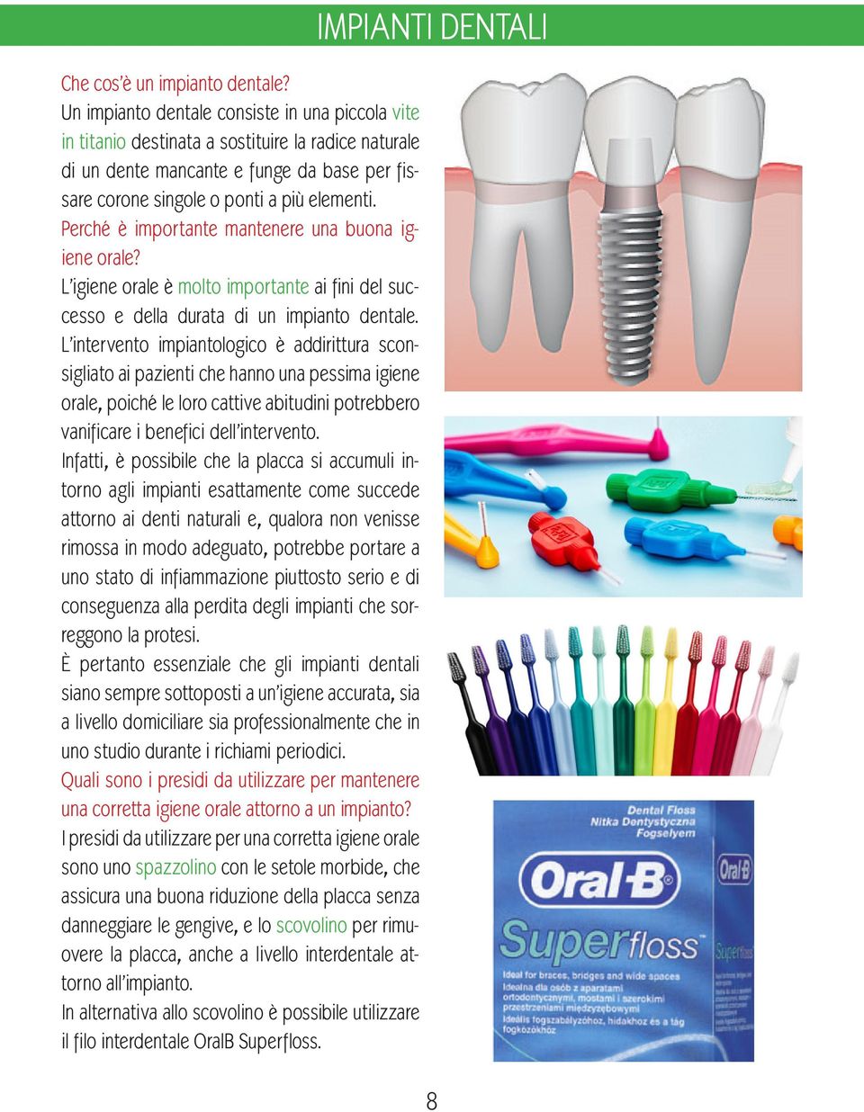 Perché è importante mantenere una buona igiene orale? L igiene orale è molto importante ai fini del successo e della durata di un impianto dentale.