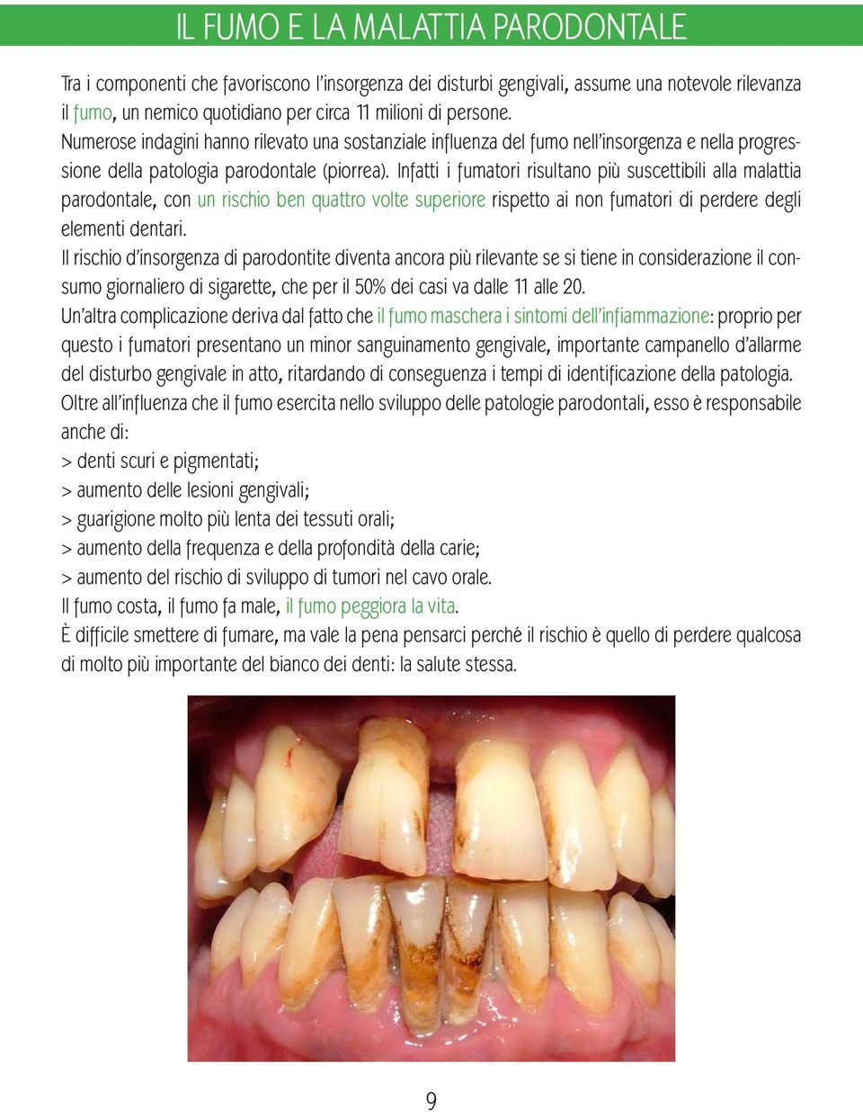 Infatti i fumatori risultano più suscettibili alla malattia parodontale, con un rischio ben quattro volte superiore rispetto ai non fumatori di perdere degli elementi dentari.