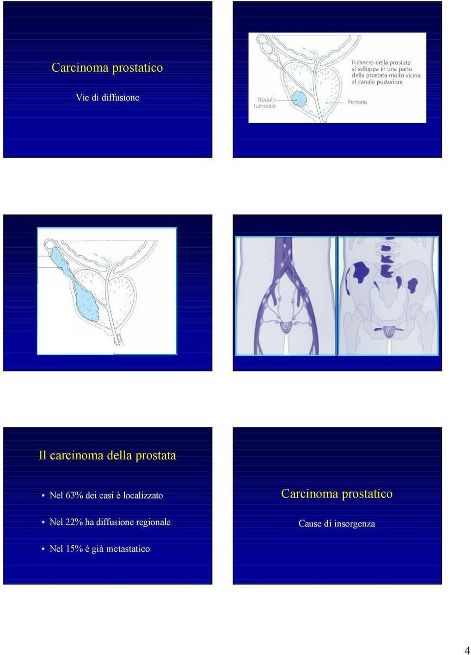 diffusione regionale Cause di