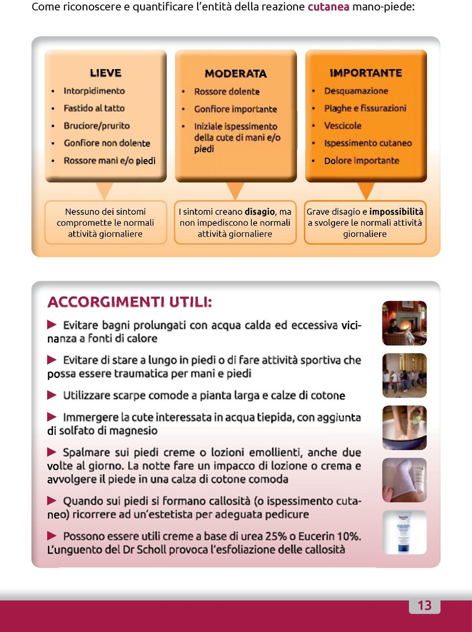 creano disagio, ma non impediscono le normali attività giornaliere Grave