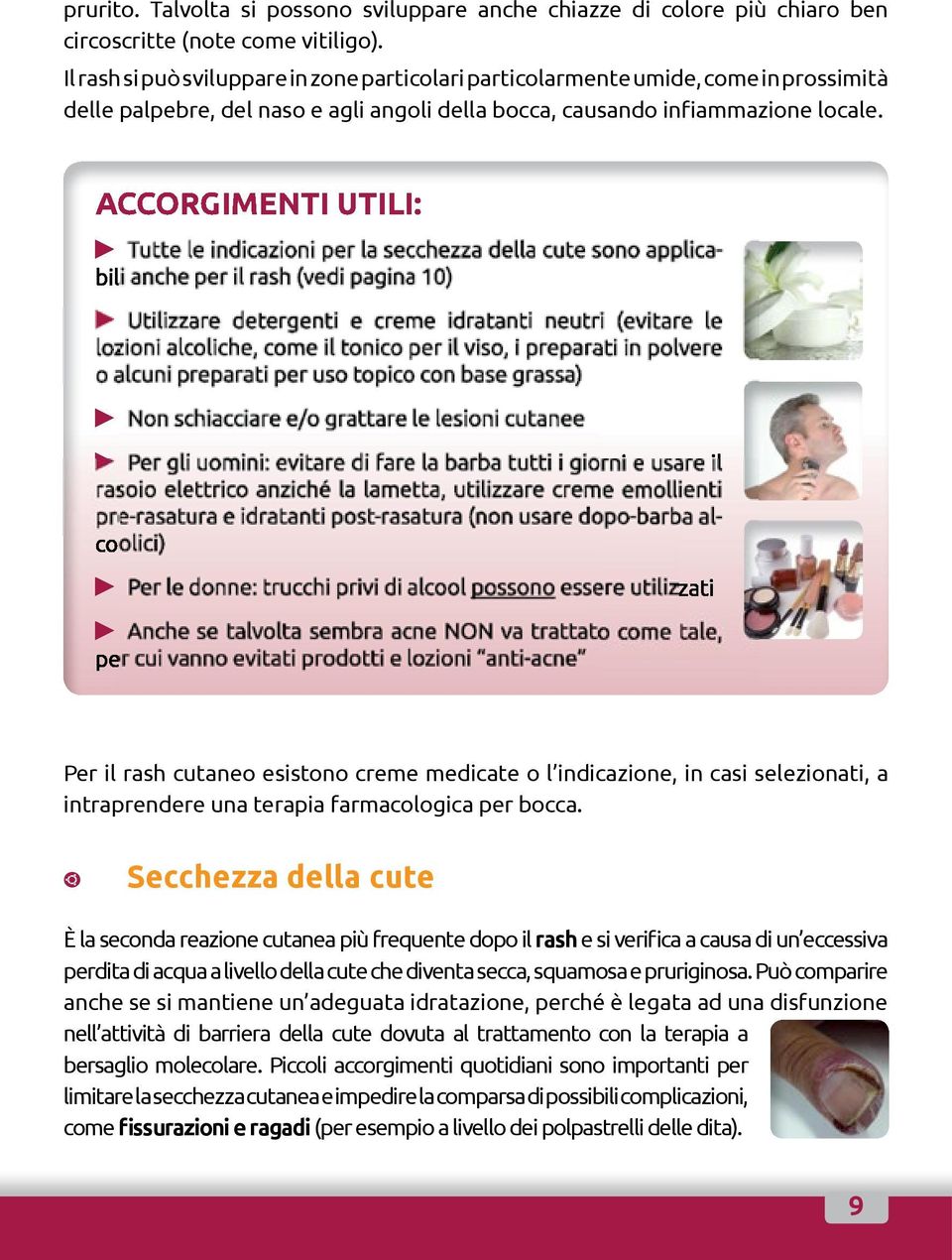 ACCORGIMENTI UTILI: Per il rash cutaneo esistono creme medicate o l indicazione, in casi selezionati, a intraprendere una terapia farmacologica per bocca.