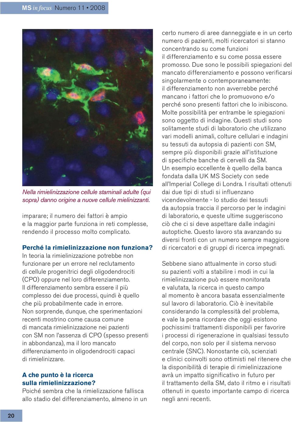 In teoria la rimielinizzazione potrebbe non funzionare per un errore nel reclutamento di cellule progenitrici degli oligodendrociti (CPO) oppure nel loro differenziamento.