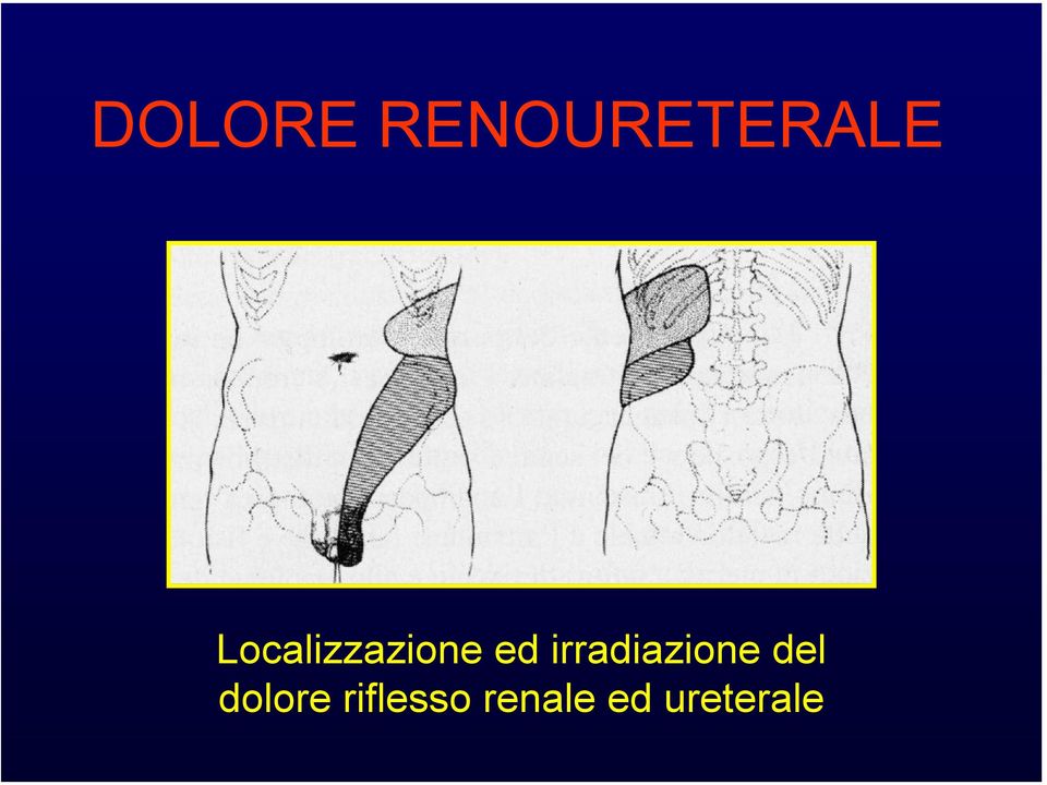 irradiazioe del