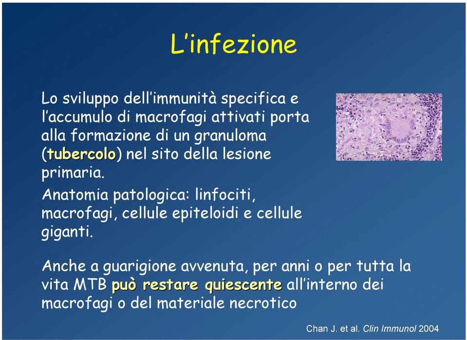 Anatomia patologica: linfociti, macrofagi, cellule epiteloidi e cellule giganti.