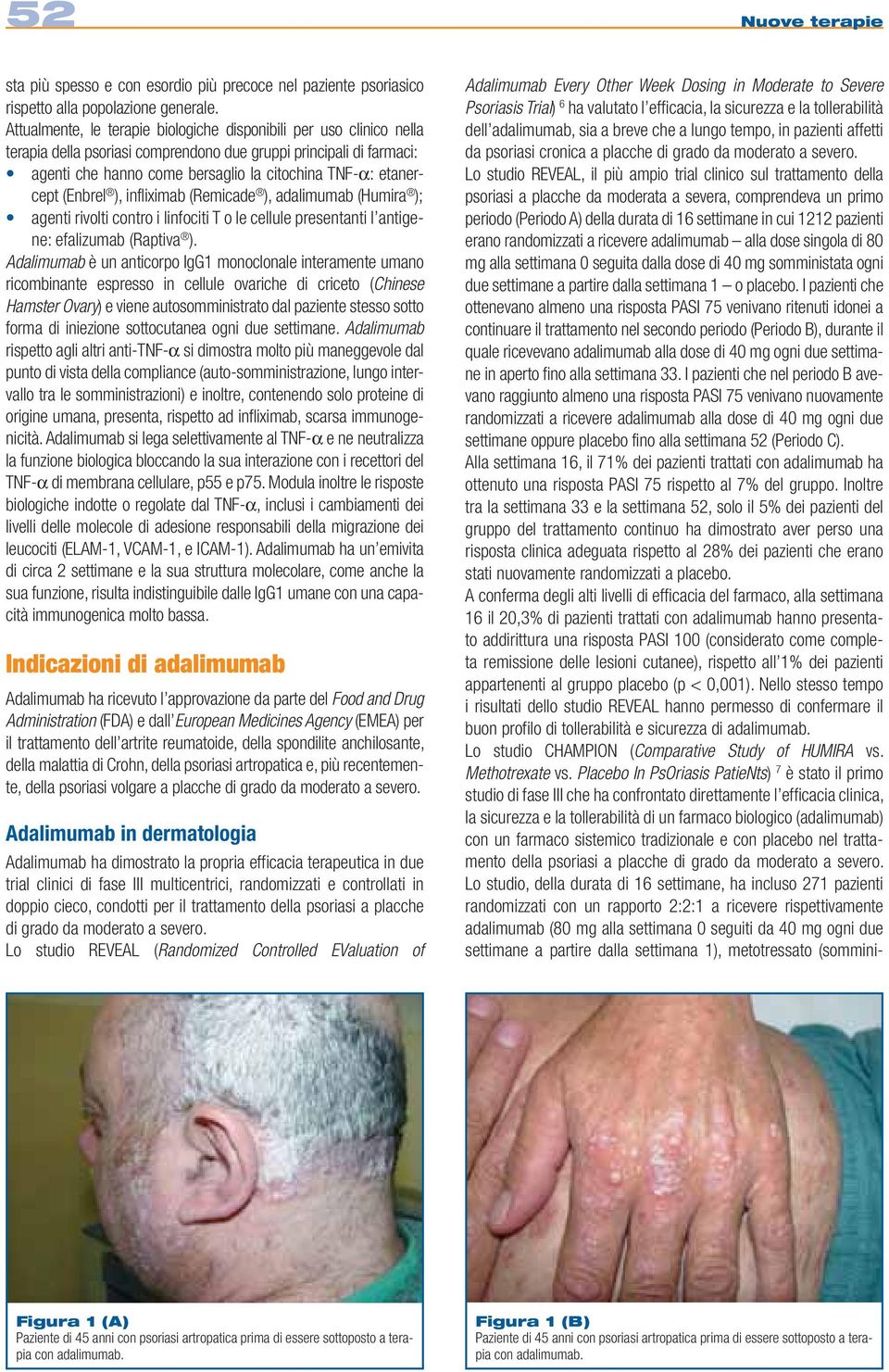 etanercept (Enbrel ), infliximab (Remicade ), adalimumab (Humira ); agenti rivolti contro i linfociti T o le cellule presentanti l antigene: efalizumab (Raptiva ).